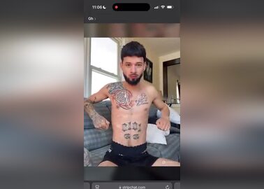 Straight man with vitiligo in panties