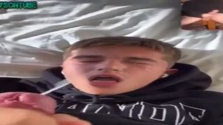 Teen facial